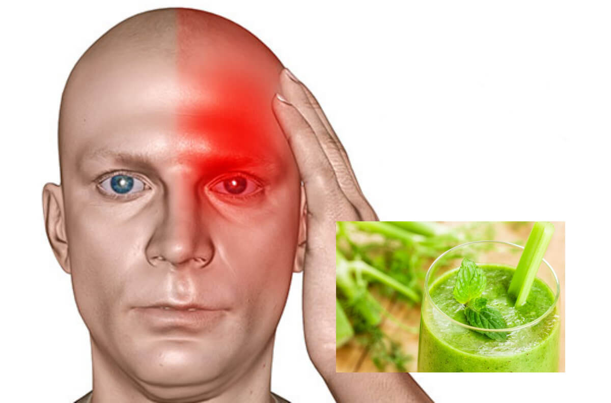 migraine wat helpt