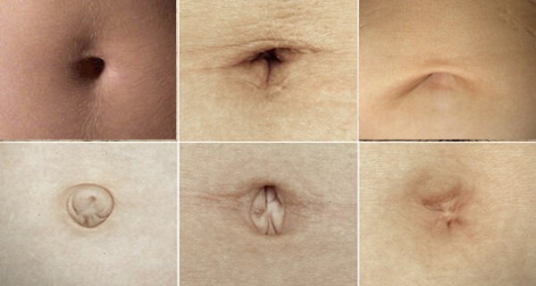 navel